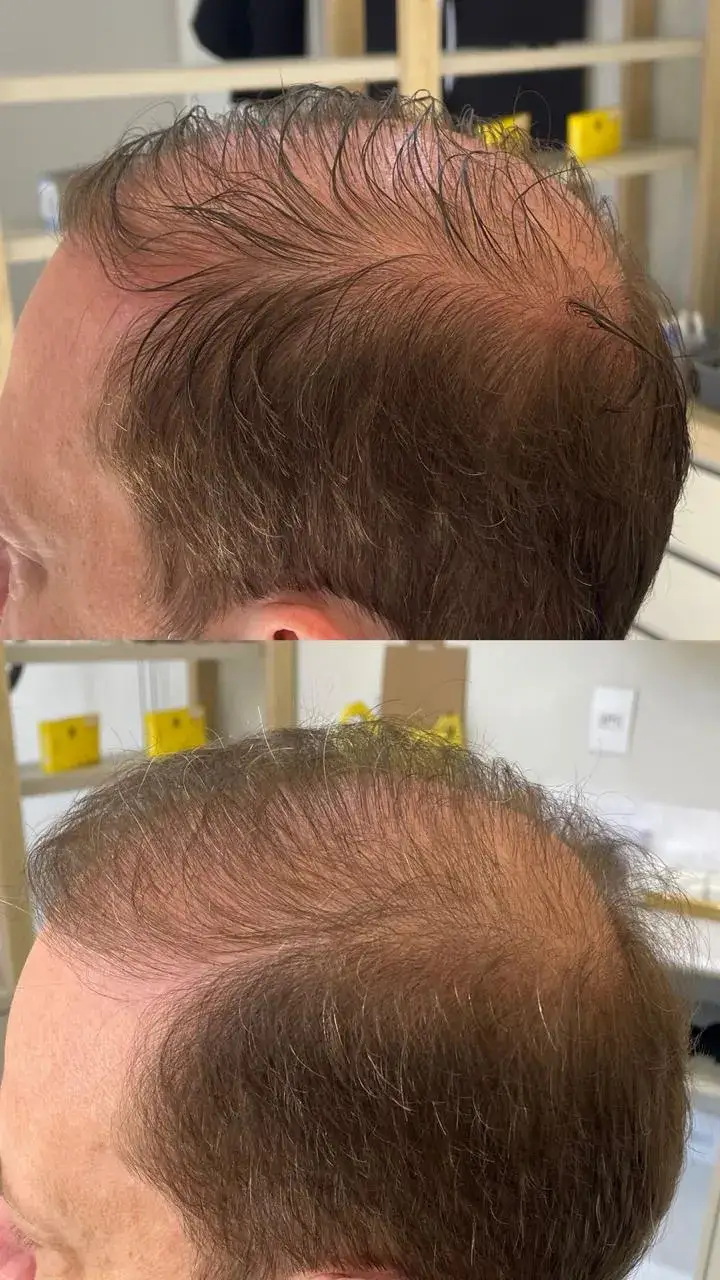 Aionê ExoHair